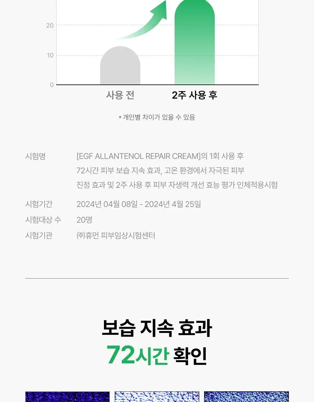 [단독기획/트러블1위] 셀인샷 알란테놀 트러블 크림 70ml 기획 (+크림 20ml*2) 상세페이지 16